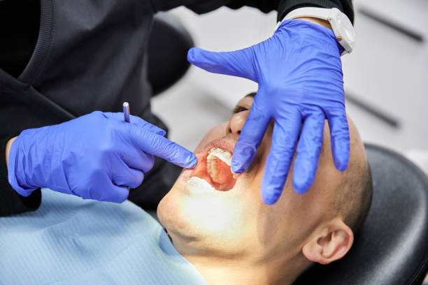 Best Emergency Broken Tooth Repair in Columbia Falls, MT