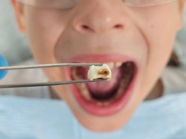 Best Same-Day Emergency Dentist in Columbia Falls, MT